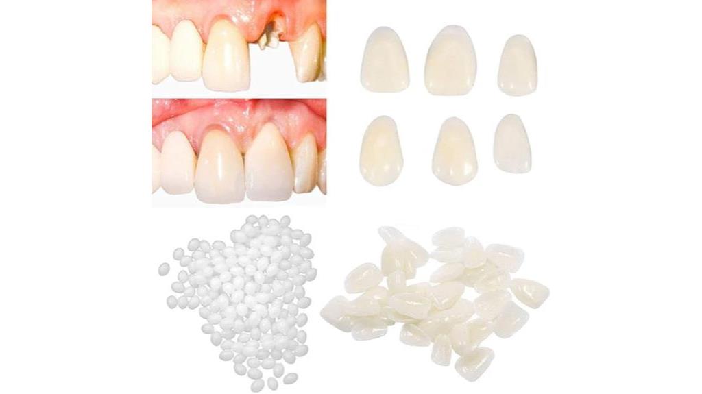 tooth repair kit bridge