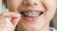 braces affect flossing routines