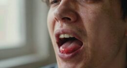 allergy season worsens bad breath