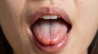 dehydration affects oral health