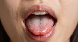 dehydration affects oral health