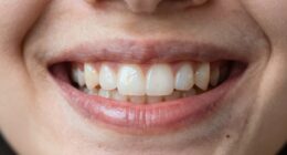 detecting enamel issues early
