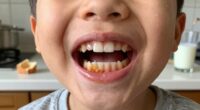 frequent snacking increases cavities