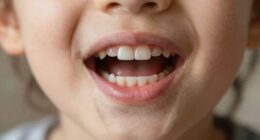 gentle patience preserves teeth
